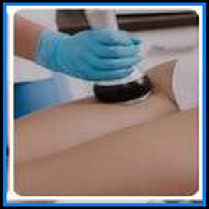 Reductivo con Radio Frecuencia
